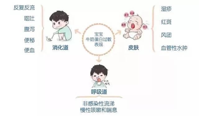 纽瑞优羊奶粉:宝宝牛奶蛋白过敏怎么办?聪明妈妈用这招